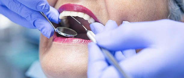 Best Emergency Dental Care for Sports Injuries in Hwatha, IA